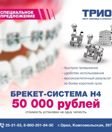 Установка брекет-системы Н4 по привлекательной цене - фото