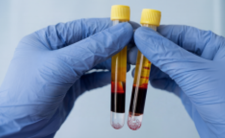 Плазмолифтинг в стоматологии: что это и как работает? - фото