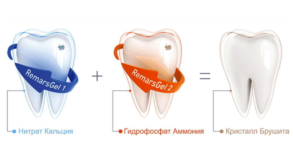 <p>Поговорим о составе препарата, выясним, как он работает, и в каких случаях его можно применять.</p>

<p>Remars Gel — лечебная зубная паста для восстановления эмали и профилактики ее разрушения. Она восполняет дефицит минералов, укрепляя твердые ткани и делая их устойчивее к агрессивным внешним факторам.</p>

<p>"РемарсГель" часто назначают после профессиональной чистки, отбеливания или исправления прикуса брекетами. Эти процедуры повышают чувствительность зубов, доставляя дискомфорт. Двухкратное применение геля снижает неприятные ощущения.</p>

<p>К слову, эффективность препарата оценили даже на МКС. Космонавты начали его использовать в 2005 году. Теперь он доступен для всех.</p>
 - фото