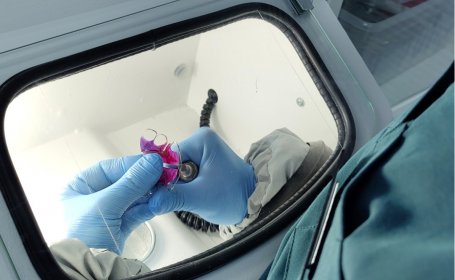Зубные пластины и брекеты: как выбрать подходящий метод коррекции прикуса - фото